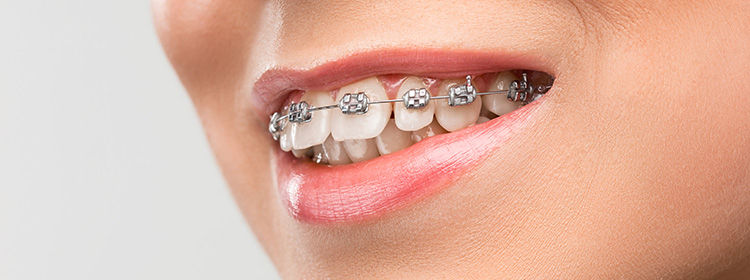 Things to Know About Orthodontics
