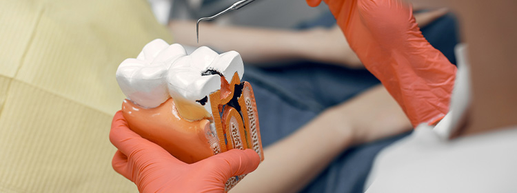 Things to Know About Root Canal Treatment
